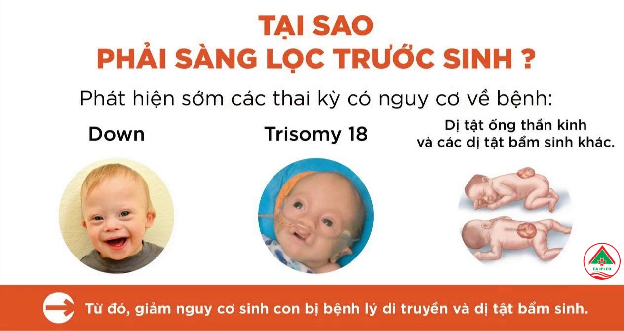 Trung tâm Y tế huyện Ea H’Leo mở rộng tầm soát, chuẩn đoán, điều trị một số bệnh tật trước sinh và sơ sinh trên địa bàn huyện năm 2025